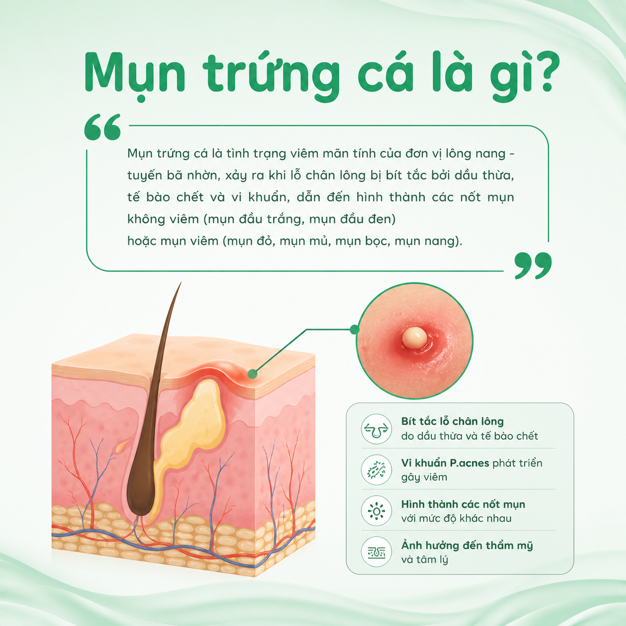 mụn trứng cá là gì